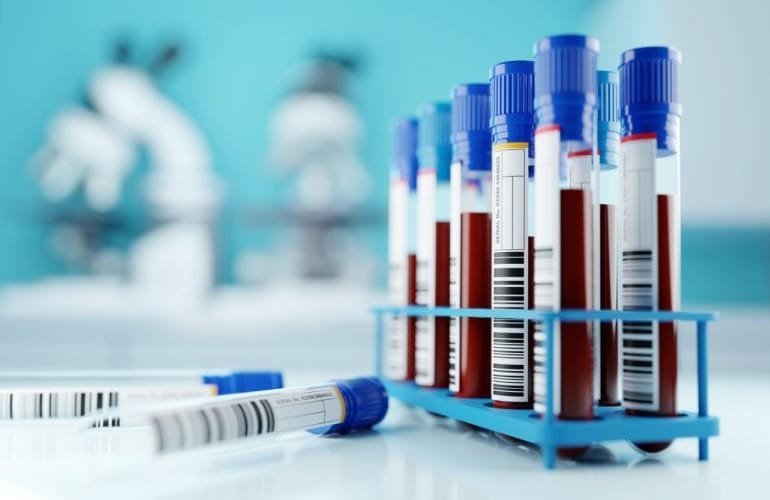 no Laboratório Endocrimeta, realizamos exames laboratoriais fundamentais para a detecção de alterações no sangue