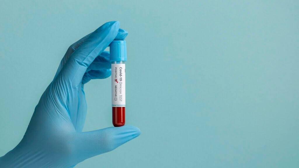 close-no-exame-de-sangue-para-omicron